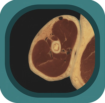 visible body project upper arm  anatomy icon